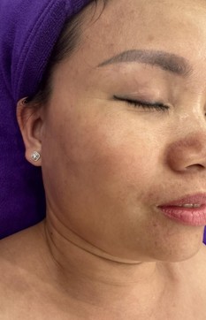 Trước liệu trình